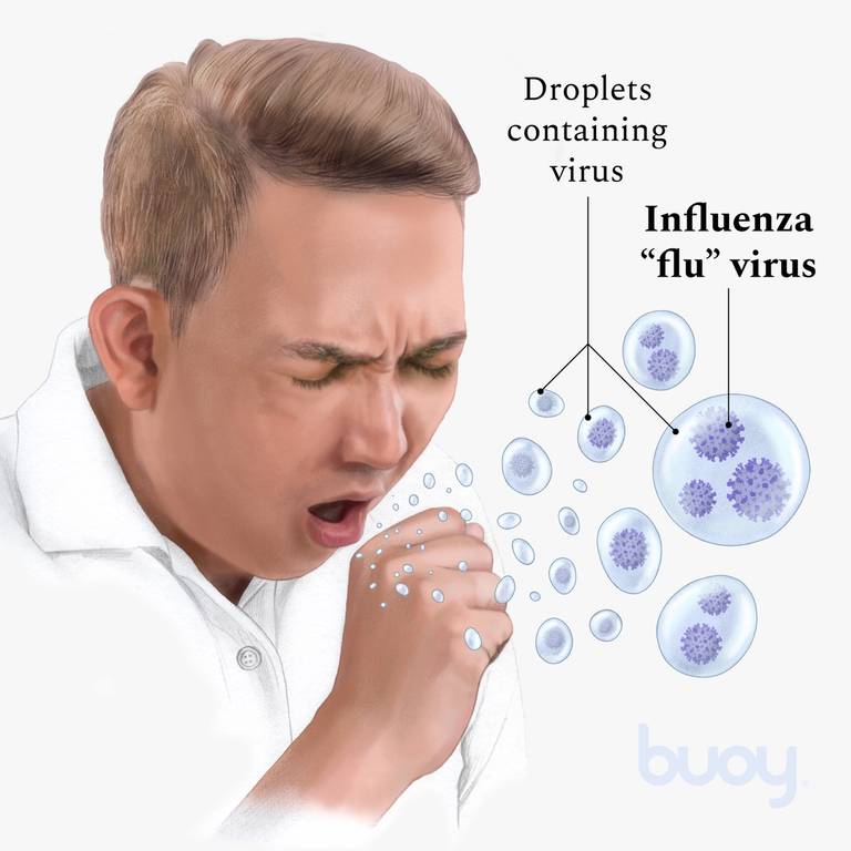 Influenza