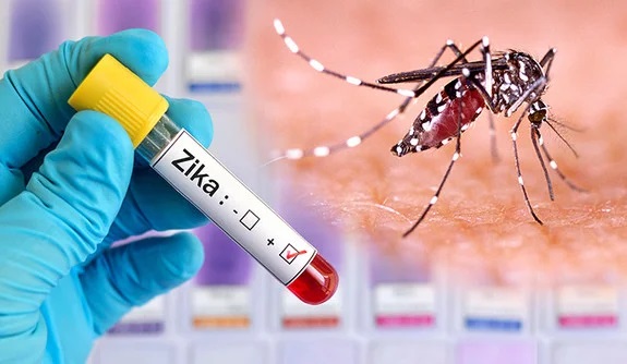 Eng Zika A Silent Virus Requiring Enhanced Surveillance And Control 2